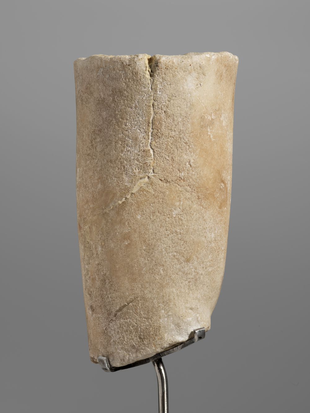 Fragment de jambe
